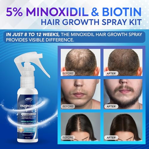 Extra Strength Minoxidil 5% Hair Growth Spray for Men & Women - 3 Pack