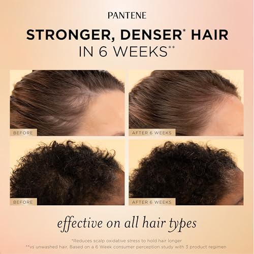 Pantene Abundant & Strong Scalp Serum, 2 oz - Hair Loss Reduction