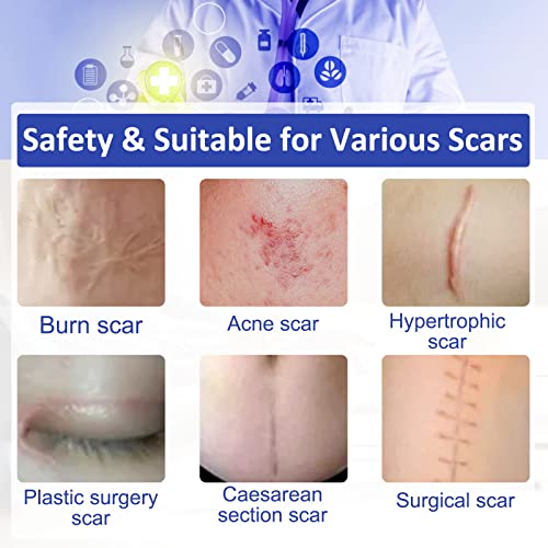 New Transparent Silicone Scar Sheets(1.6¡± x 120¡±Inch - 3M),Away Scar Tape,Scar Strips, Reusable, Professional Scar Removal Sheets for C-Section, Surgery, Burn, Keloid, Acne et, Scar Patch.