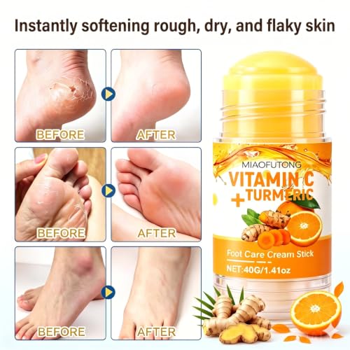 Incamity Electric Callus Remover with Foot Cream & 3 Speeds