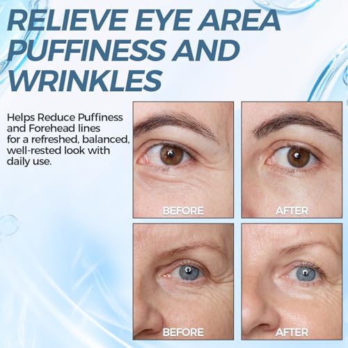 Instant Lift Eye Serum for Under Eye Bags, Wrinkles & Puffiness