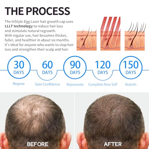 InStyle Egg 272 Laser Hair Growth Cap for Men & Women