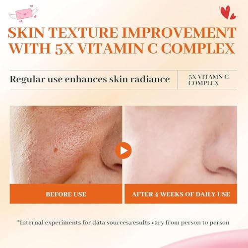 Vitamin C Face Toner 130ml, HONLINK 5X Vitamin C Complex with Niacinamide & Hyaluronic Acid, Hydrating & Balancing Toner for Daily Skincare, Valentine¡¯s Day Gift for Her