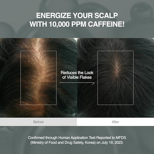 FLOLAND Scalp Hair Growth Serum with Caffeine - Hair Loss & Thinning Treatment