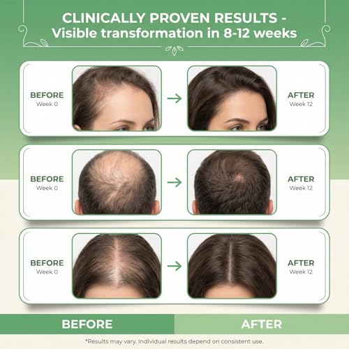 Rosemary & Rice Water Hair Growth Spray with Biotin & Caffeine - 2oz