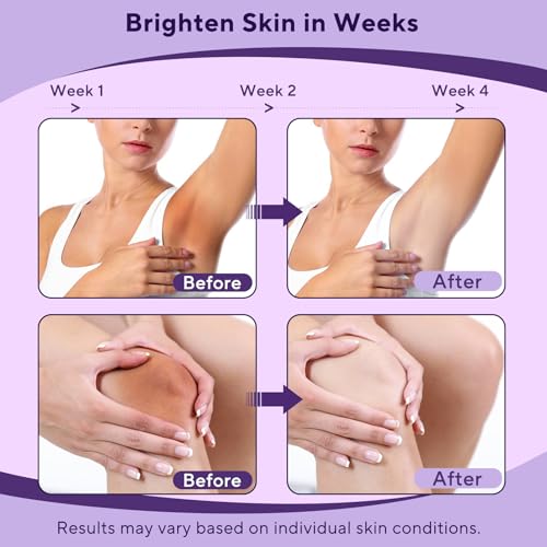 Skin Bleaching Cream, Skin Lightening Cream with Vitamin C for Intimate Areas, Dark Spot Remover for Body, Sensitive, Intimate Areas Underarms, Knees, Elbows, Inner Thighs & Bikini Line, 3.4 Fl Oz