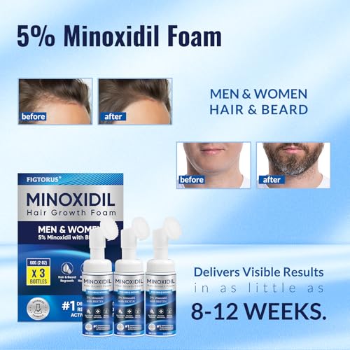 5% Minoxidil Foam for Hair Growth - Men & Women