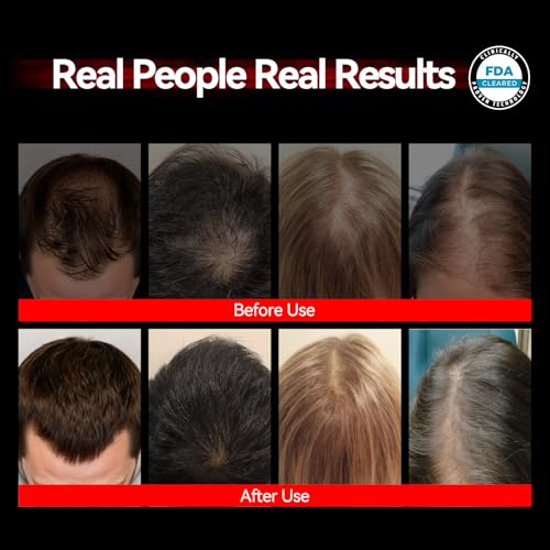 Laser Hair Growth Cap - FDA Cleared LLLT Device