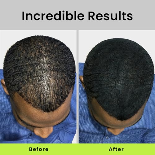 ECLIPSE Hair Fibers Medium Brown 15g - Instant Thicker Hair