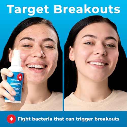 Hypochlorous Acid Spray for Face (8oz, Reduces Acne), Targets Bacteria - HOCL Facial Cleanser Acne Spray for Face, Body, Eczema, Pimples, Breakouts & Overall Skin Recovery (Reduces Redness)