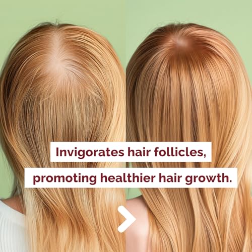 Onion & Rosemary Hair Growth Shampoo - Thickening & Strengthening, 16 oz