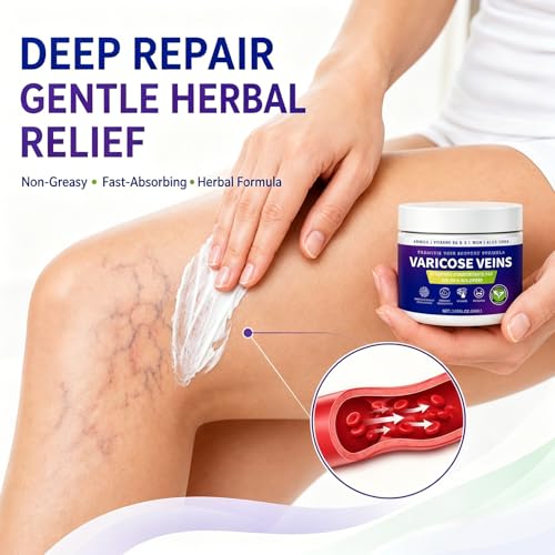 Varicose Veins Cream for Legs with MSM & Arnica