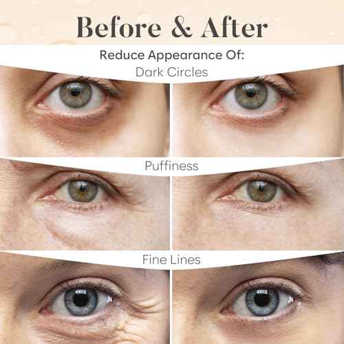 AURAE Caffeine Under Eye Patches (30 Pairs) - For Dark Circles & Puffiness - Hydrating Caffeine Eye Mask