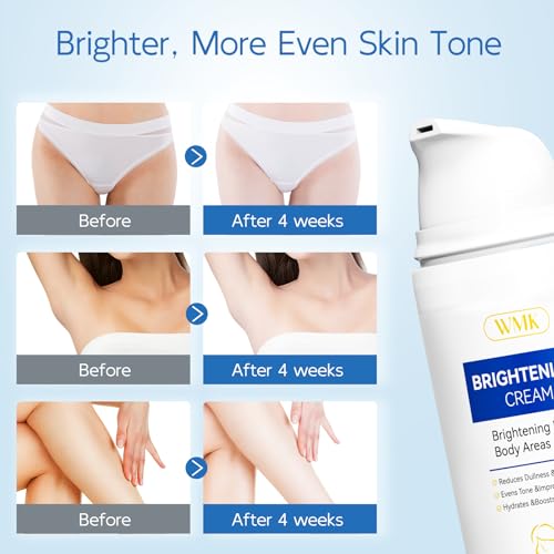 WMK Skin Bleaching Cream for Intimate Areas ? Vitamin C Dark Spot Remover for Underarms, Knees, Elbows & Bikini Line