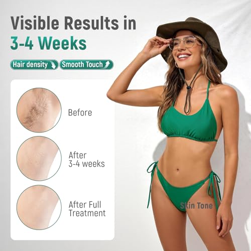 IPL Laser Hair Removal Device with Ice Cooling - FDA Cleared 5 Levels for Face & Body