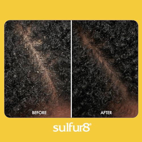 SULFUR8 Medicated Anti-Dandruff Conditioner 2 oz