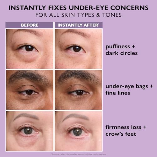 Peter Thomas Roth Instant FIRMx Eye Tightener | Under-Eye Bags