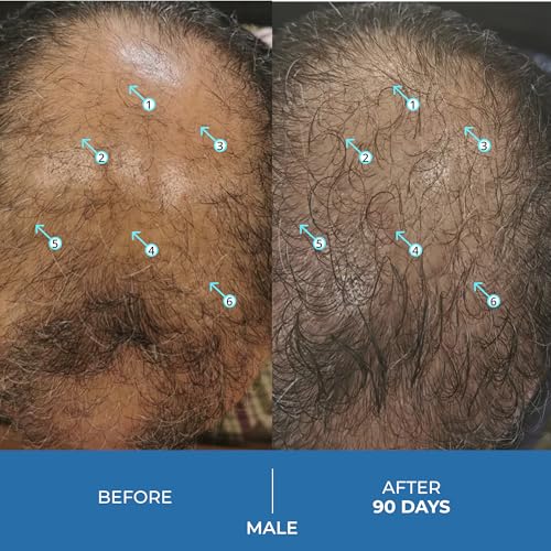 DS Labs Spectral.UHP 5% Minoxidil Hair Serum for Thinning Hair - 60ml