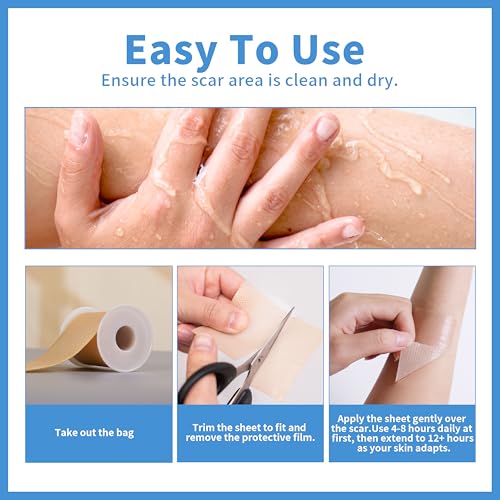 Silicone Scar Sheets (1.6¡± x 120¡± Roll-3M), Scar Tape for Surgical Scars, Reusable, Professional for Keloid Bump Removal, Surgical, C-Section, Tummy Tuck
