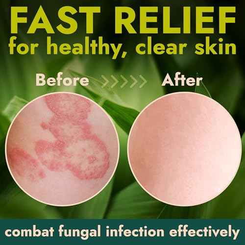 Antibacterial Body Lotion Antifungal Cream | Kills 99.9% of Germs and Bacteria | Helps Sanitize Skin | Infused with Botanical Extracts | Leaves Skin Fresh, Soft & Moisturized | Body Lotion 4 fl oz