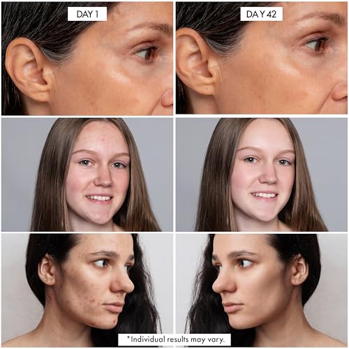 Dr. Crazy Millionaire Glow Vitamin C Serum for Face - Hydrating Glow Up Serum With Turmeric, Niacinamide, Hyaluronic Acid, Snail Mucin & Vitamin E - Fades Dark Spots & Evens Skin Tone ? 30ml