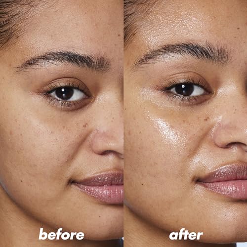 Eucerin Eczema Relief Hydrogel for Dry, Itchy, Eczema-Prone Skin, Fragrance Free and Steroid Free Body Moisturizer for Dry Skin, 5 Fl Oz Tube