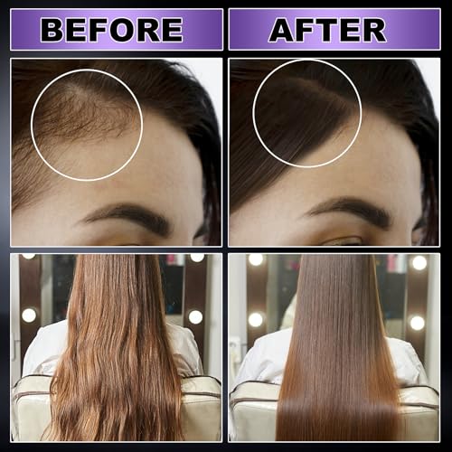 GIFBEA Organic Black Rice Water Hair Growth Serum Spray 5oz with Rosemary & Biotin