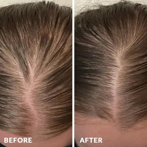 PureNaturis Rosemary Rice Water Hair Growth System Kit