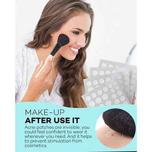 TKTK Pimple Patch Acne Patch, 4 Sizes 280 Patches Acne Absorbing Cover Patch, Hydrocolloid Invisible Acne Patches For Face Zit Patch Acne Dots Tea Tree, Calendula Oil - 2 Pack