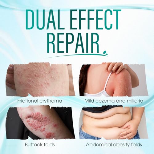 Intertrigo Relief Cream ? Intertrigo Cream for Belly Folds with 10% Undecylenic Acid & 15% Zinc Oxide, Fast-Drying, Non-Greasy Support for Friction-Prone Areas, 60ml (1)