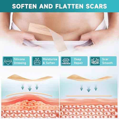 Silicone Scar Sheets, Silicone Scar Tape(5.7¡± x 1.57¡± 10 Pcs), Scar Removal Away Strips for Surgical Scars, Keloid, C-Section, Burn et