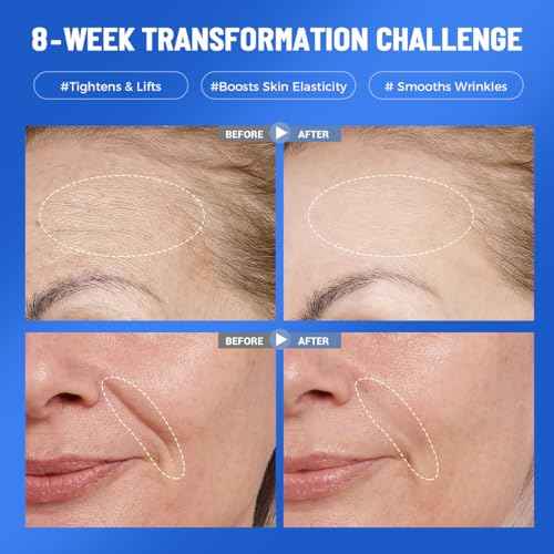 7 Pack Collagen Face Mask Deep Hydrating Overnight Facial Mask with Hyaluronic Acid Moisturizing Skincare Hydrogel Mask for Hydrating, Firming & Brightening