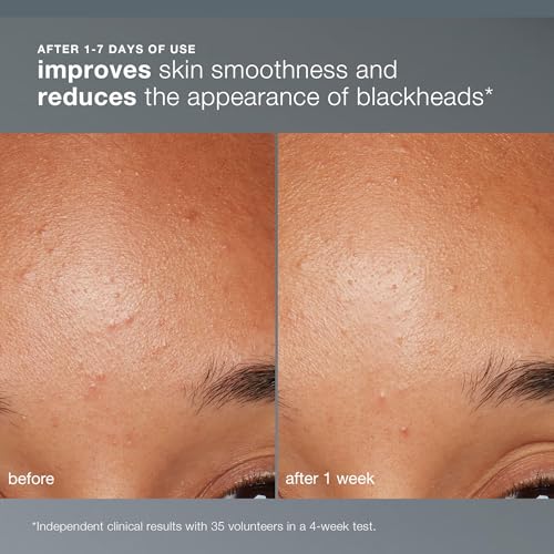 Dermalogica Daily Microfoliant Face Exfoliator Powder