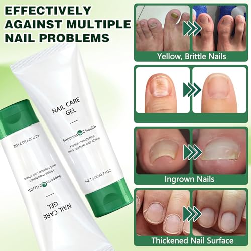 Natural Nail Repair Gel with Olive Oil & Tea Tree - 2pc Set