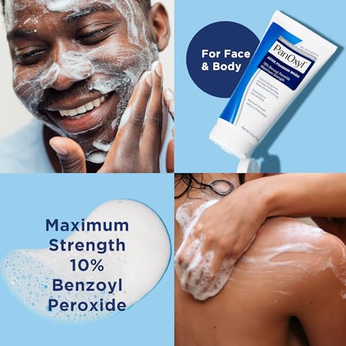 PanOxyl Acne Foaming Wash Benzoyl Peroxide 10% Maximum Strength Antimicrobial, 5.5 Oz