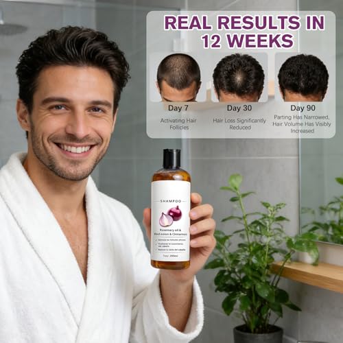Onion Biotin Rosemary Shampoo for Hair Growth - 200ML
