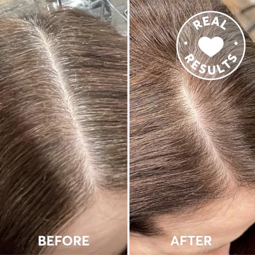 Madison Reed Root Perfection Root Touch-Up Kit 7N Alba - Light Brown, 2 Applications