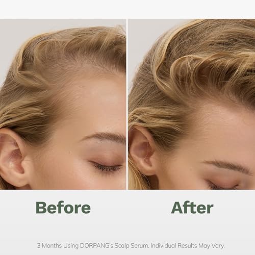 DORPANG Scalp Serum for Thinning Hair 60ml - Hair Thickening with Peptides & Natural Oils