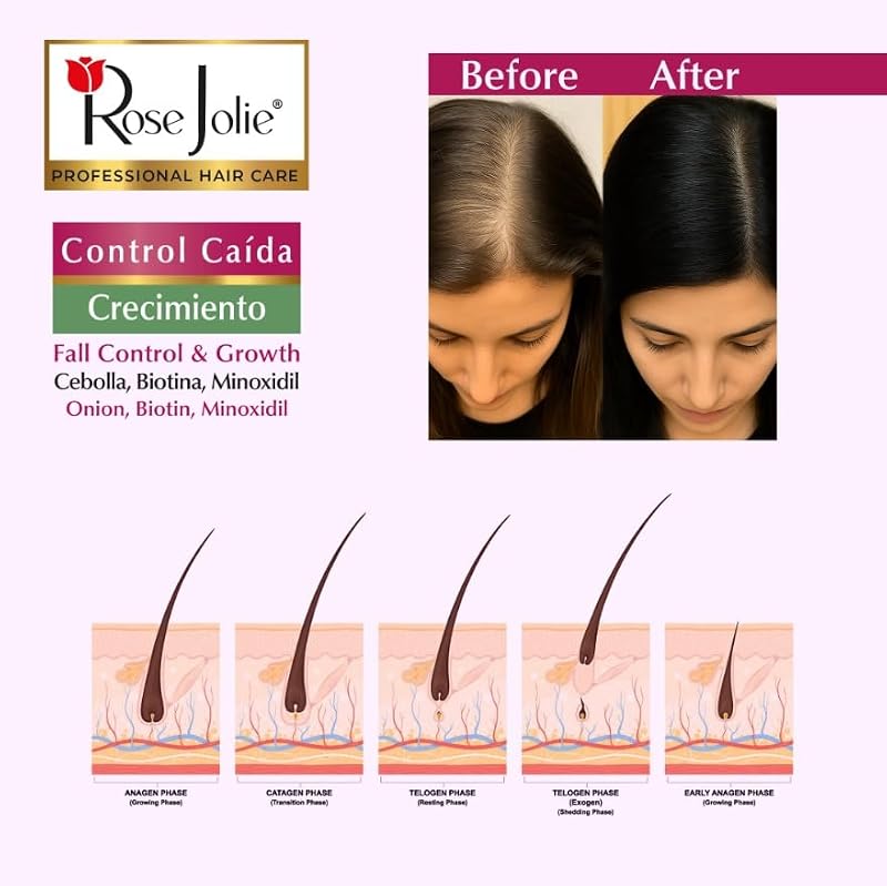 Rose Jolie Onion & Biotin Hair Tonic Spray | Hair Growth & Fall Control