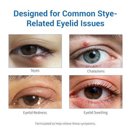 Stye Treatment Set : Eye Relief Serum with Rollerball, Tea Tree Wipes & Steam Masks for Styes, Blepharitis, Chalazion ? Soothes Redness, Irritation & Daily Care for Sensitive Eyes