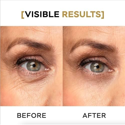 VITASEI Moisturizing Eye Cream w/Aloe Vera, Collagen, Hyaluronic Acid, Cotton Stem Cells for Dark Circles, Puffiness & Bags - Under Eye Hydration Cream for Women & Men (1 Fl Oz)