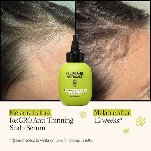 ReGRO Anti-Thinning Scalp Serum 5% Capixyl, 3oz