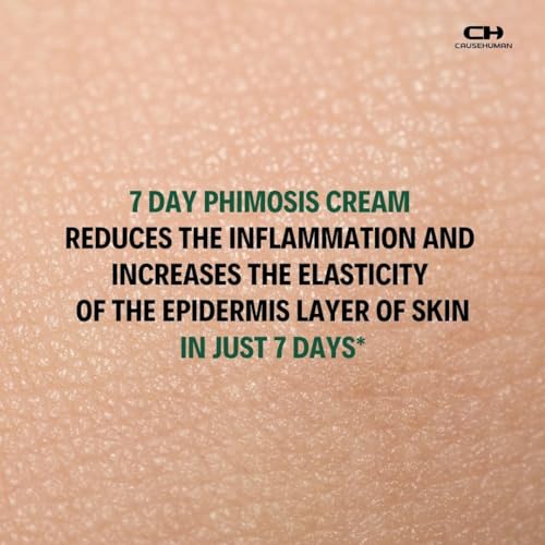 7-Day Phimosis Cream | Steroid-Free Treatment for Fast Relief at Home | Visible Results in 7 Days* | 3.16 fl oz (90g) | No Irritation | No Steroids (7 Day Phimosis Relief Cream)
