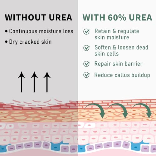 60% Urea Cream Maximum Strength – Cracked Foot & Hand Repair