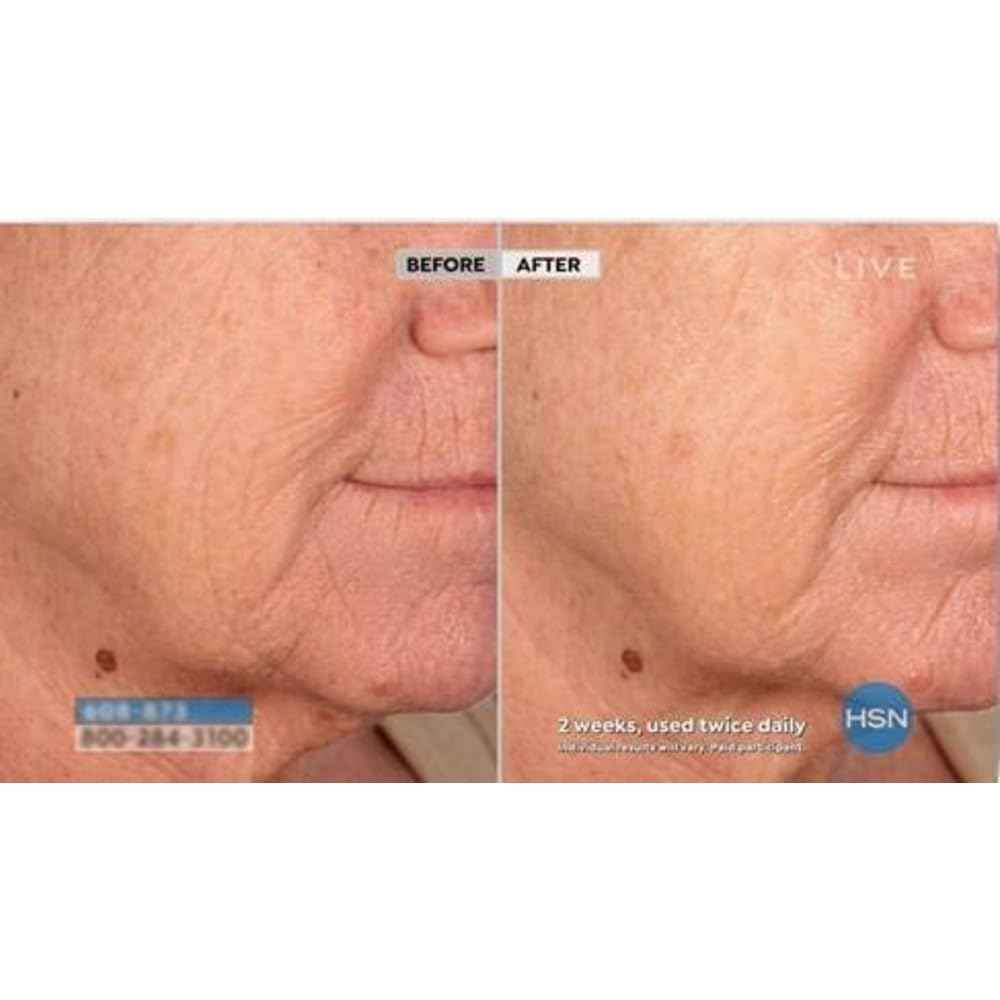 NASSIF MD Hydro-Screen Face And Body Souffle, Hydrating Skin Moisturizer, Hyaluronic Acid, Omega 3, Anti Aging, Even Skin Tone, 4 Fl Oz