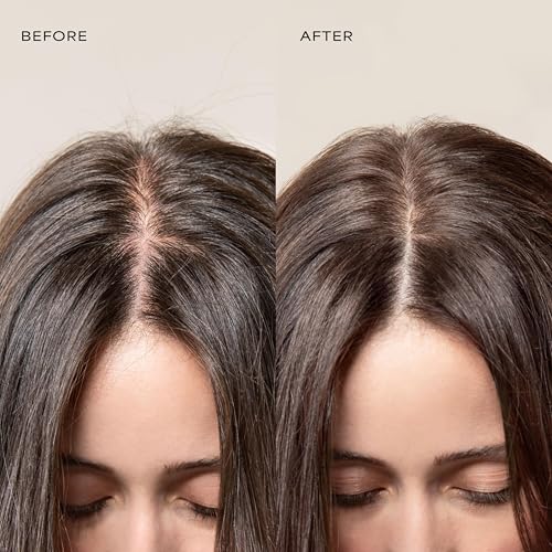 Raw Sugar Dry Scalp Treatment Bundle - 4-Piece Hair Care Kit