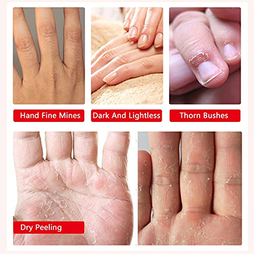 AIQIUSHA Collagen Moisturizing Hand Mask Gloves for Dry Cracked Hands - 4 Pack