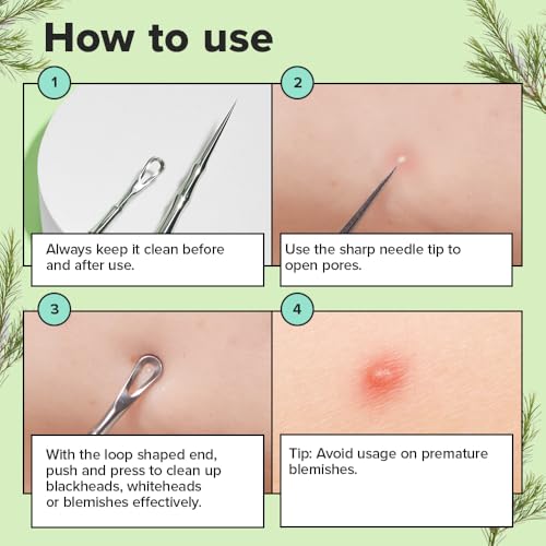 I DEW CARE Dual-Tip Pimple Popper Tool | Blackhead Remover