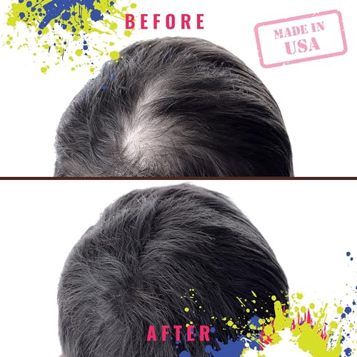 Advanced Hair Growth Serum with 4.65% 2DDR - All-Natural Formula for Men & Women