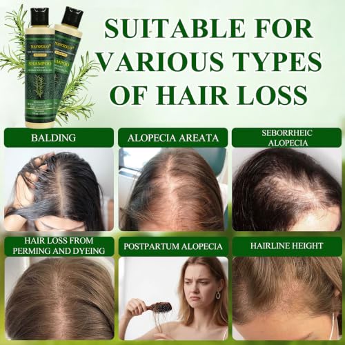 Rosemary Keratin Shampoo for Hair Loss & Thinning Hair